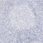 Immunohistochemical staining of human tonsil shows no positivity in germinal center cells as expected.