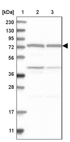 Lane 1: Marker [kDa] 230, 130, 95, 72, 56, 36, 28, 17, 11_br/_Lane 2: Human cell line RT-4_br/_Lane 3: Human cell line U-251MG sp