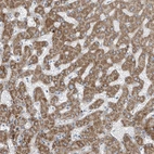 Immunohistochemical staining of human liver shows strong cytoplasmic positivity in hepatocytes.
