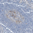 Immunohistochemical staining of human lymph node shows moderate membranous positivity in germinal center cells.