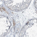 Immunohistochemical staining of human testis shows moderate membranous positivity in Leydig cells.