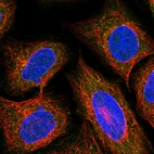 Immunofluorescent staining of human cell line SiHa shows localization to vesicles.