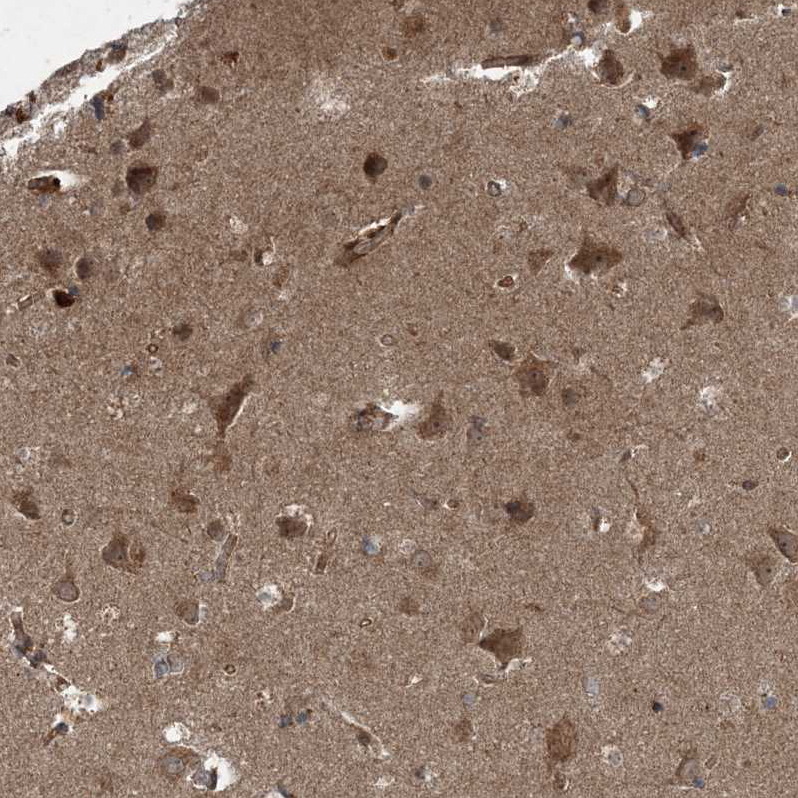 Anti-COPS7B Antibody