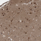 Anti-COPS7B Antibody