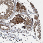 Immunohistochemical staining of human testis shows strong cytoplasmic positivity in Leydig cells.