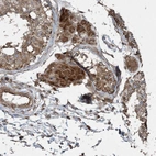 Immunohistochemical staining of human testis shows strong cytoplasmic positivity in Leydig cells.