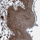 Immunohistochemical staining of human skin shows strong cytoplasmic positivity in squamous epithelial cells.