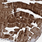 Immunohistochemical staining of human skeletal muscle shows strong cytoplasmic positivity in myocytes.