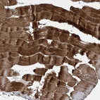 Immunohistochemical staining of human skeletal muscle shows strong cytoplasmic positivity in myocytes.