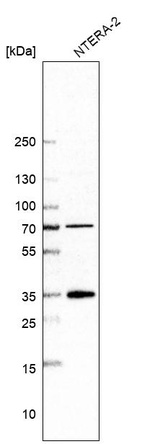 Western blot analysis in human cell line NTERA-2.