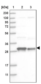 Lane 1: Marker [kDa] 230, 130, 95, 72, 56, 36, 28, 17, 11_br/_Lane 2: Human cell line RT-4_br/_Lane 3: Human cell line U-251 MG
