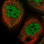Immunofluorescent staining of human cell line A-431 shows localization to nucleoplasm.