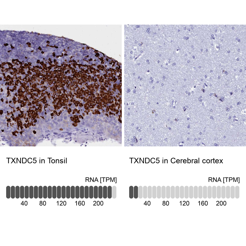 Anti-TXNDC5 Antibody