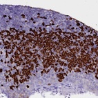 Immunohistochemical staining of human tonsil shows high expression.