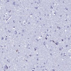 Immunohistochemical staining of human cerebral cortex shows low expression as expected.