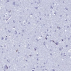 Immunohistochemical staining of human cerebral cortex shows low expression as expected.
