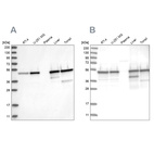 Western blot analysis using Anti-TXNDC5 antibody HPA034677 (A) shows similar pattern to independent antibody HPA034678 (B).