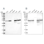 Western blot analysis using Anti-TXNDC5 antibody HPA034677 (A) shows similar pattern to independent antibody HPA034678 (B).