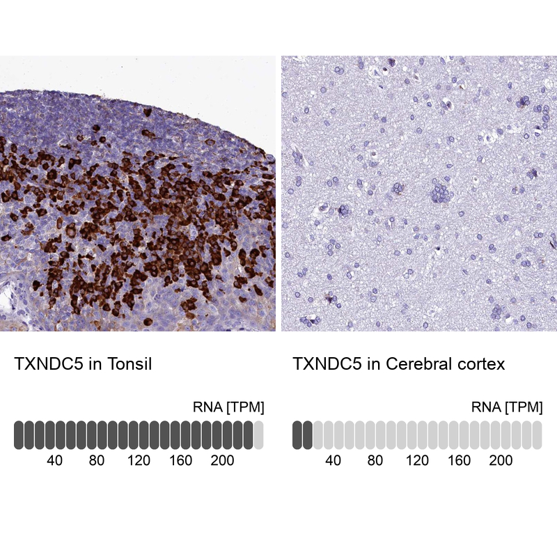 Anti-TXNDC5 Antibody