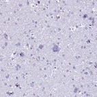 Immunohistochemical staining of human cerebral cortex shows low expression as expected.