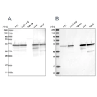 Western blot analysis using Anti-TXNDC5 antibody HPA034678 (A) shows similar pattern to independent antibody HPA034677 (B).