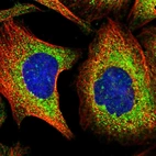 Immunofluorescent staining of human cell line U-2 OS shows localization to endoplasmic reticulum.