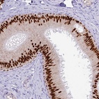 Anti-TFAP2B Antibody