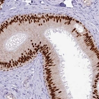 Anti-TFAP2B Antibody
