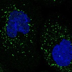 Anti-SPOPL Antibody