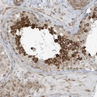 Anti-CHCHD4 Antibody