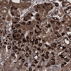 Anti-SCRN3 Antibody