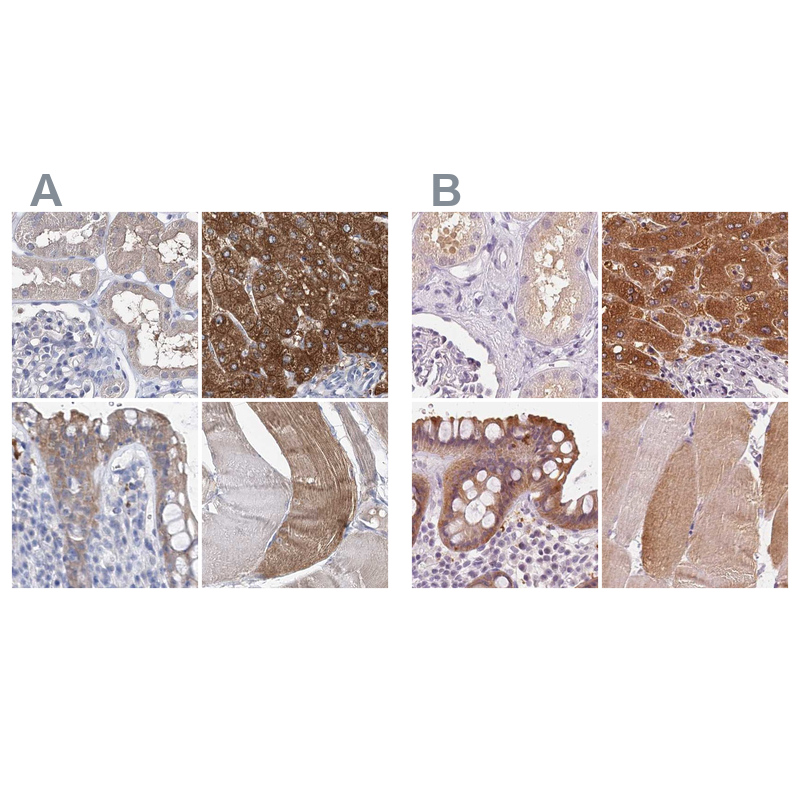 Anti-UGP2 Antibody
