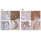 Anti-UGP2 Antibody