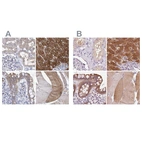 Anti-UGP2 Antibody