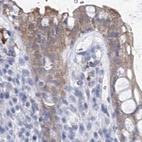 Immunohistochemical staining of human rectum using Anti-UGP2 antibody HPA034696.