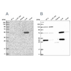 Western blot analysis using Anti-UGP2 antibody HPA034696 (A) shows similar pattern to independent antibody HPA034697 (B).