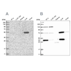 Western blot analysis using Anti-UGP2 antibody HPA034696 (A) shows similar pattern to independent antibody HPA034697 (B).