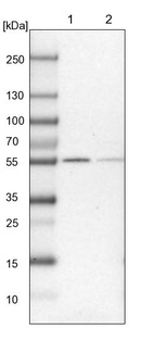 Lane 1: Mouse liver tissue lysate_br/_Lane 2: Rat liver tissue lysate