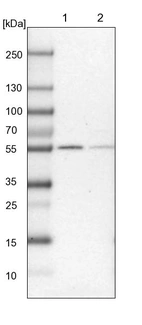 Lane 1: Mouse liver tissue lysate_br/_Lane 2: Rat liver tissue lysate