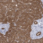 Anti-UGP2 Antibody
