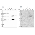Western blot analysis using Anti-UGP2 antibody HPA034697 (A) shows similar pattern to independent antibody HPA034696 (B).