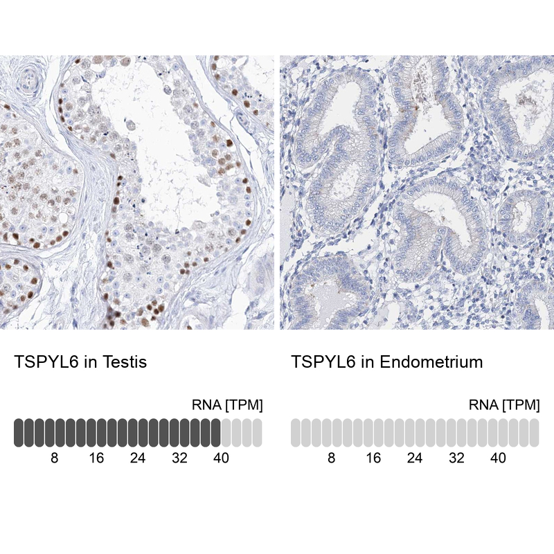 Anti-TSPYL6 Antibody