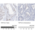 Anti-TSPYL6 Antibody