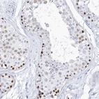 Immunohistochemical staining of human testis shows high expression.