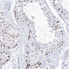 Immunohistochemical staining of human testis shows high expression.