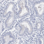 Immunohistochemical staining of human endometrium shows low expression as expected.