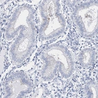 Immunohistochemical staining of human endometrium shows low expression as expected.