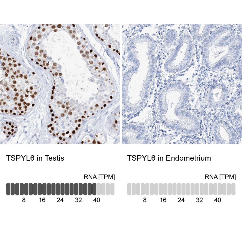 Anti-TSPYL6 Antibody