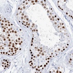 Immunohistochemical staining of human testis shows high expression.