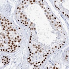 Anti-TSPYL6 Antibody